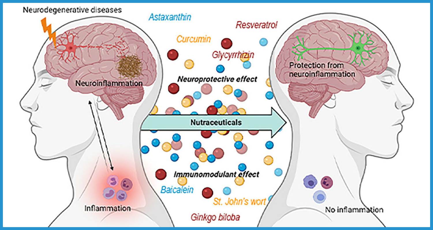 showing the image of " Neurodegenerative Diseases ", one of the 6 top scientific achievements in 2024.